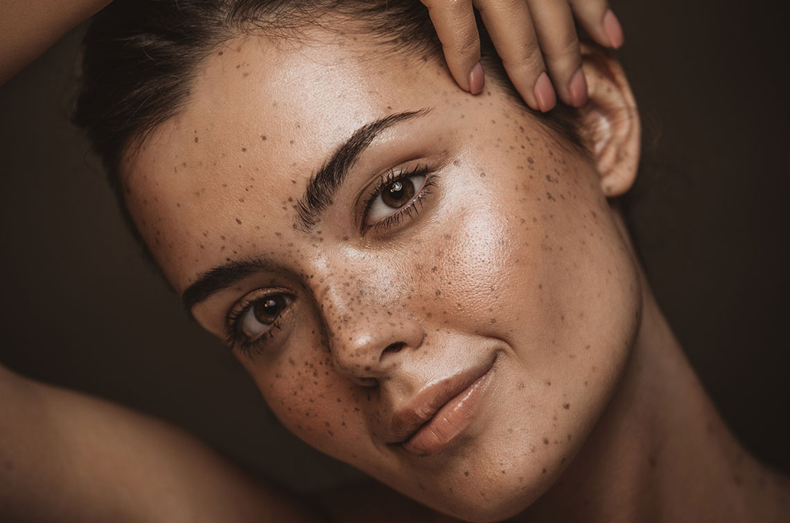 client after botox in bend, or